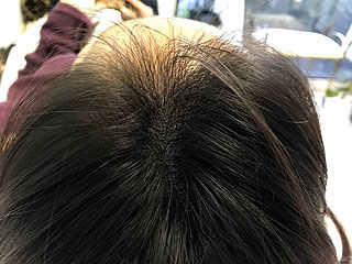 ヘアーアートメイク施術例