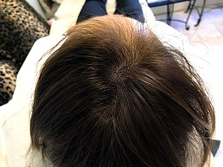 ヘアーアートメイク施術例