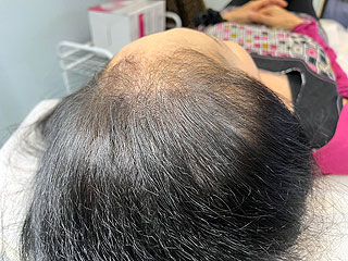 ヘアーアートメイク施術例